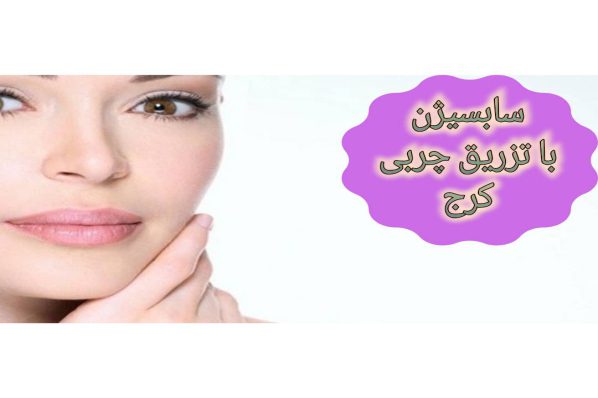 سابسیژن با تزریق چربی کرج