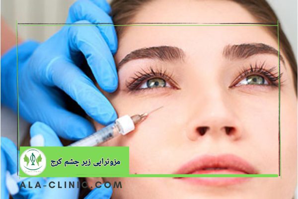 مزوتراپی زیرچشم کرج