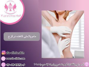 ماموپلاستی کاهنده درکرج