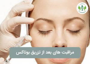 مراقبت های بعد از بوتاکس در کرج