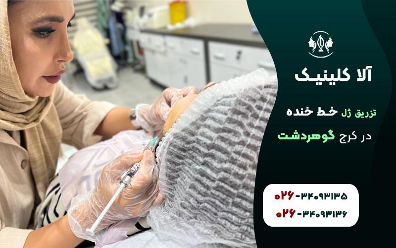 تزریق ژل خط خنده در گوهردشت