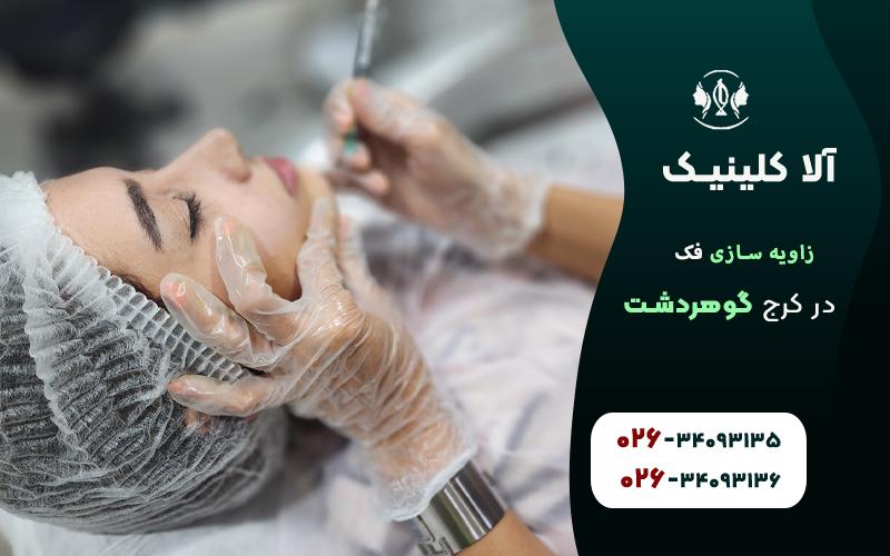 زاویه سازی صورت در کرج