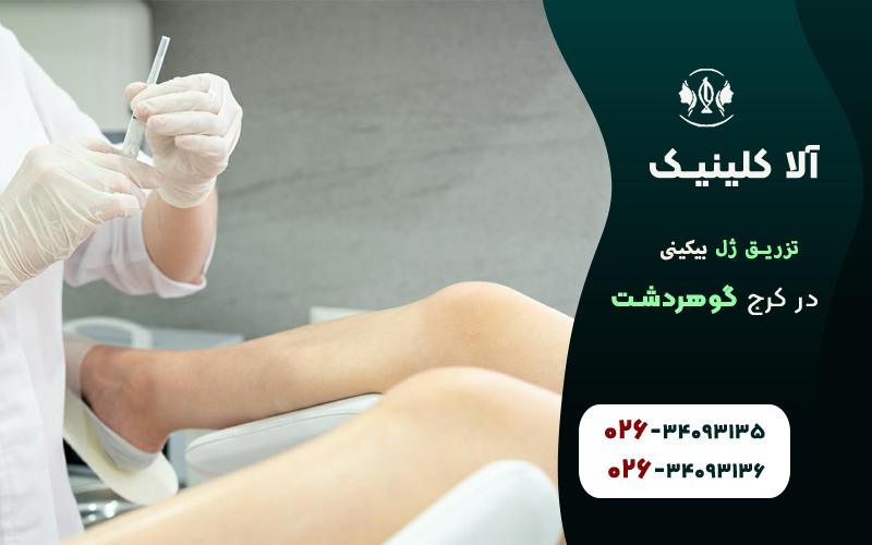 تزریق ژل بیکینی گوهردشت کرج