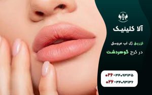 تزریق ژل لب عروسکی