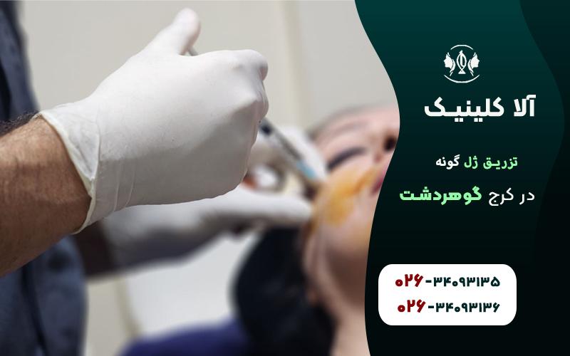 تزریق ژل گونه در کرج