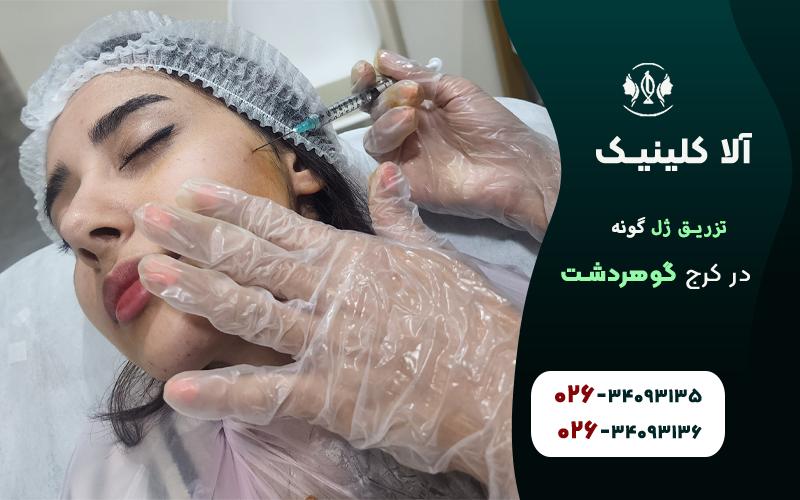 تزریق ژل گونه در کرج