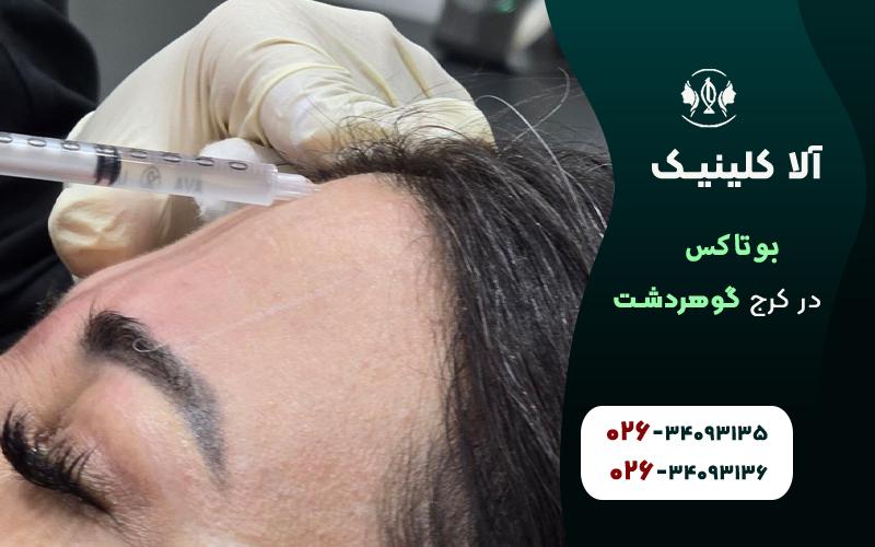 بوتاکس کرج