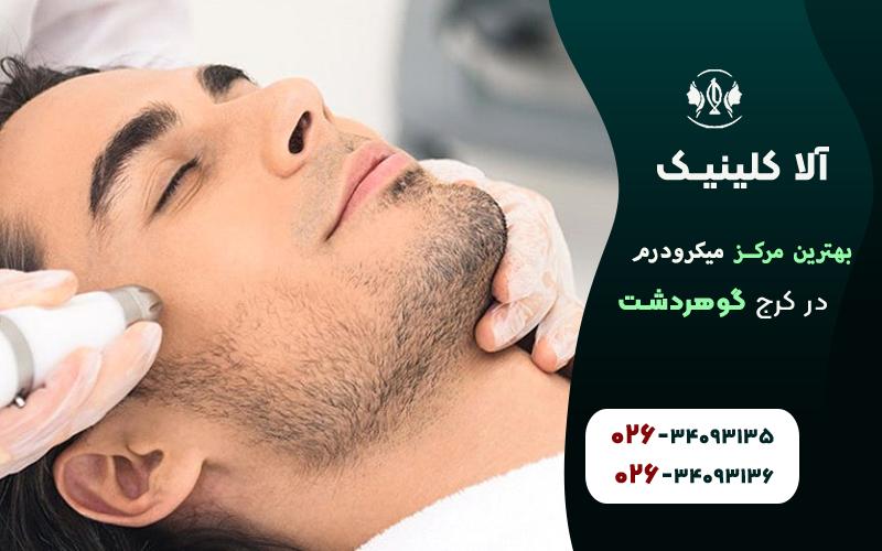 بهترین مرکز میکرودرم در کرج