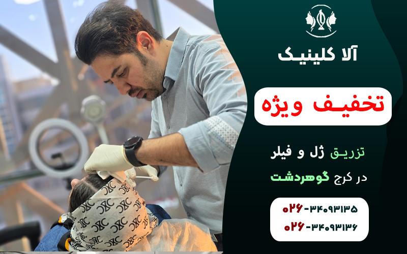 تزریق ژل و فیلر در کرج با تخفیف ویژه