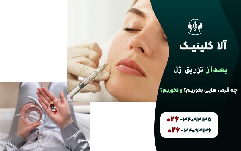 بعد از تزریق ژل چه قرص هایی بخوریم؟ چه قرص هایی نخوریم!؟