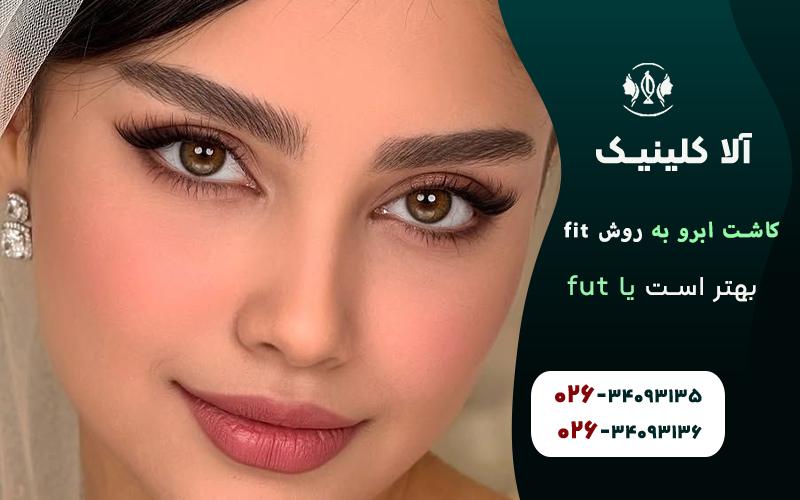 کاشت ابرو به روش fit بهتر است یا fut