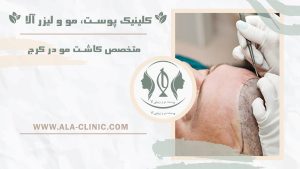 متخصص کاشت مو در کرج