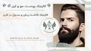 کلینیک کاشت ریش و سبیل در کرج