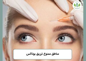 مناطق-ممنوع-تزریق-بوتاکس