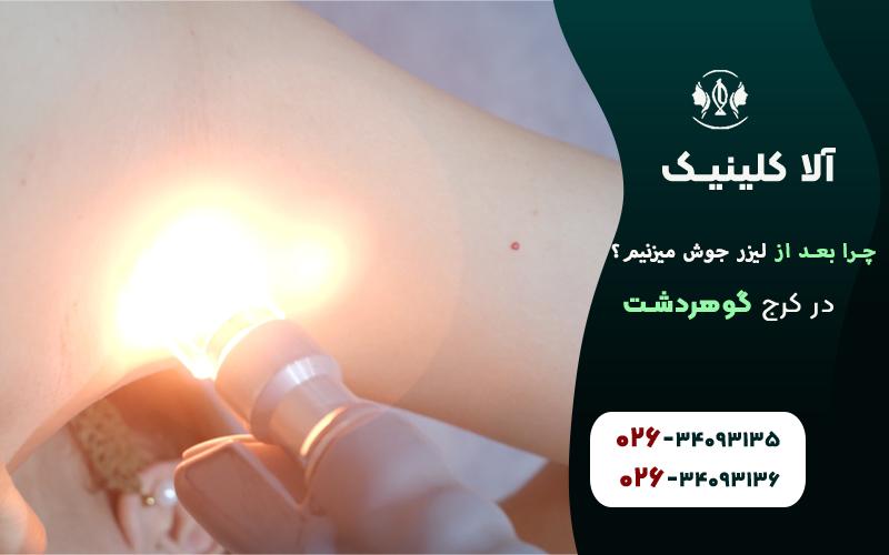 دلایل جوش زدن بعد از لیزر