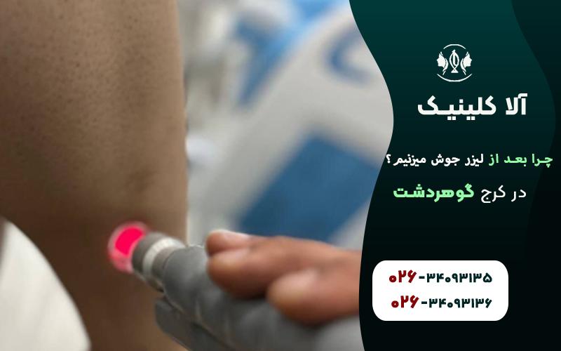 علت جوش زدن بعد از لیزر