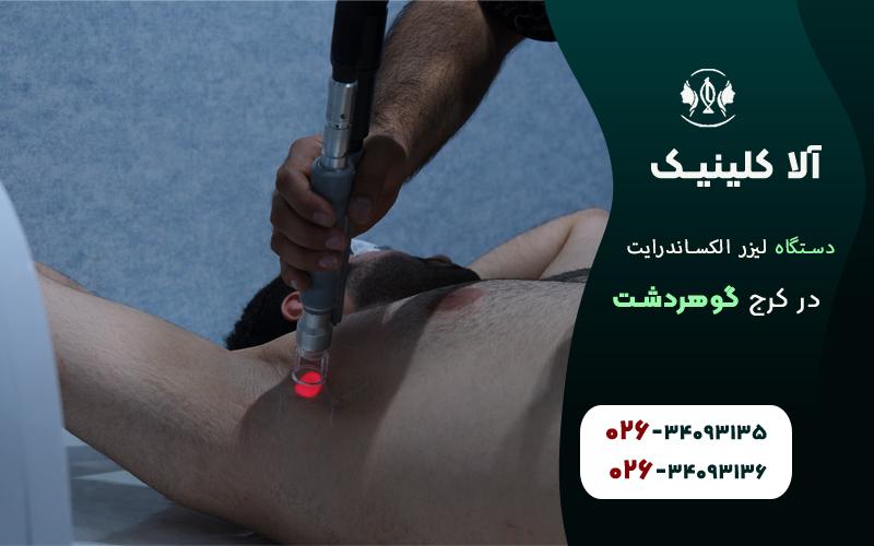 لیزر الکساندرایت چند جلسه است