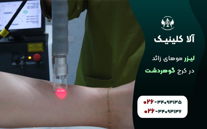 لیزر موهای زائد بیکینی در آلا کلینیک