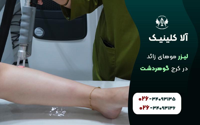 لیزر موهای زائد بیکینی در کلینیک آلا