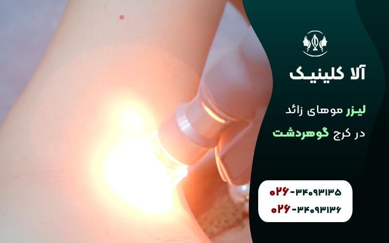 لیزر موهای زائد زیر بغل در گوهردشت