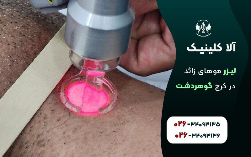 لیزر موهای زائد در گوهردشت کرج