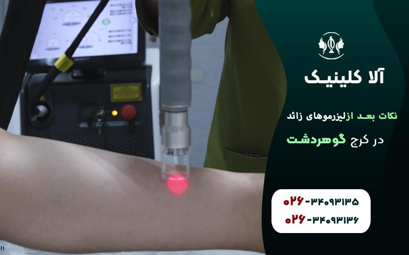 10نکته حیاتی برای بعد از لیزر موهای زائد