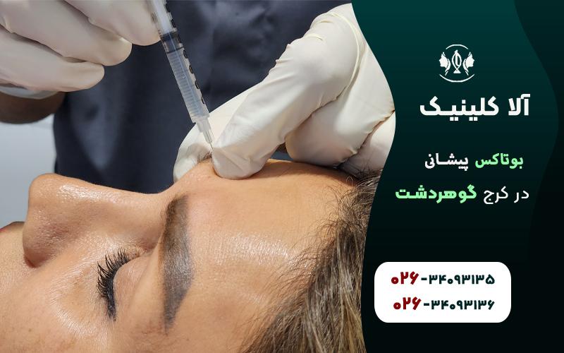بوتاکس پیشانی کرج