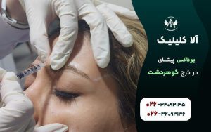 بوتاکس پیشانی کرج