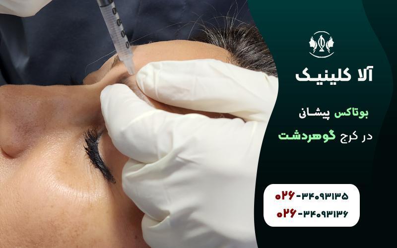 بوتاکس پیشانی کرج