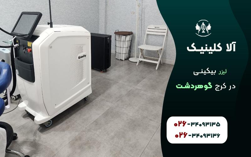 لیزر بیکینی در کرج