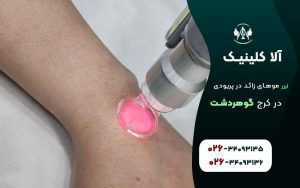 لیزر موهای زائد ذر هنگام پریودی