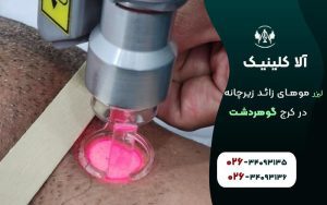 لیزر موهای زائد زیرچانه در کرج