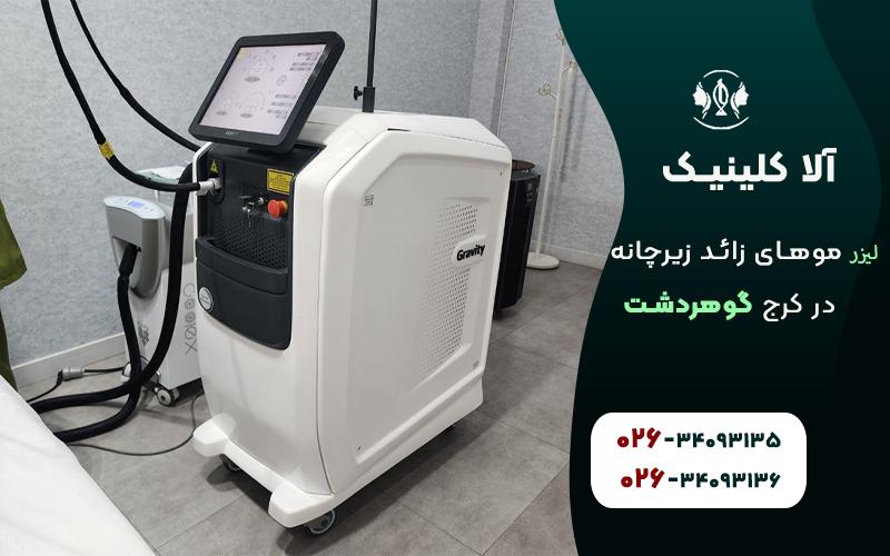لیزر موهای زائد زیرچانه در کرج