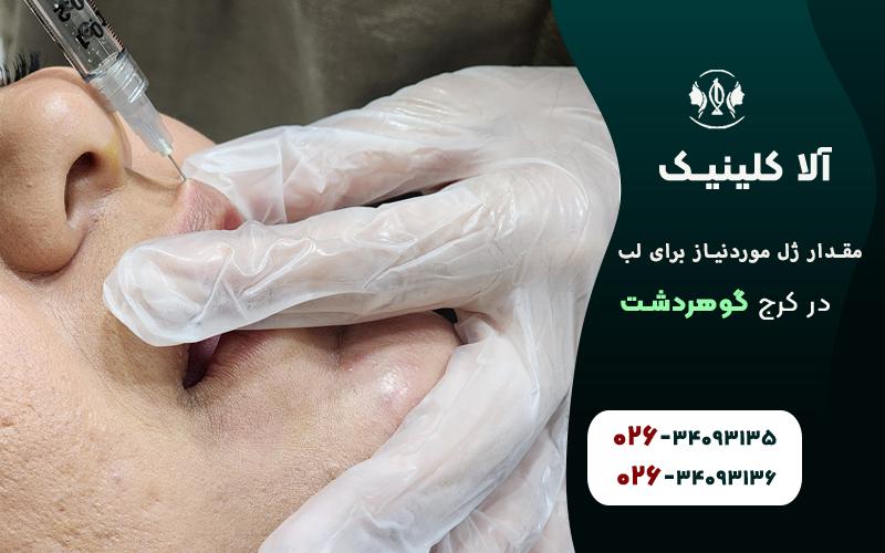 چند سی سی ژل برای تزریق لب نیاز است