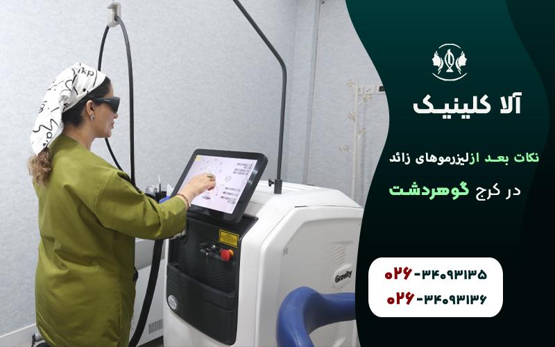 10نکته حیاتی برای بعد از لیزر موهای زائد