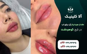 چند سی سی ژل برای تزریق لب مورد نیاز است؟