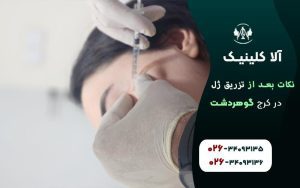 10نکته بعد از تزریق ژل که باید بدانید
