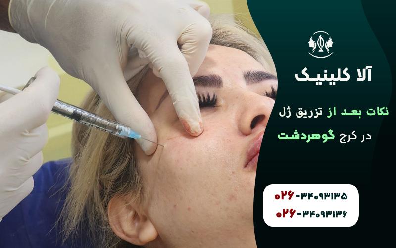 10نکته بعد از تزریق ژل که باید بدانید