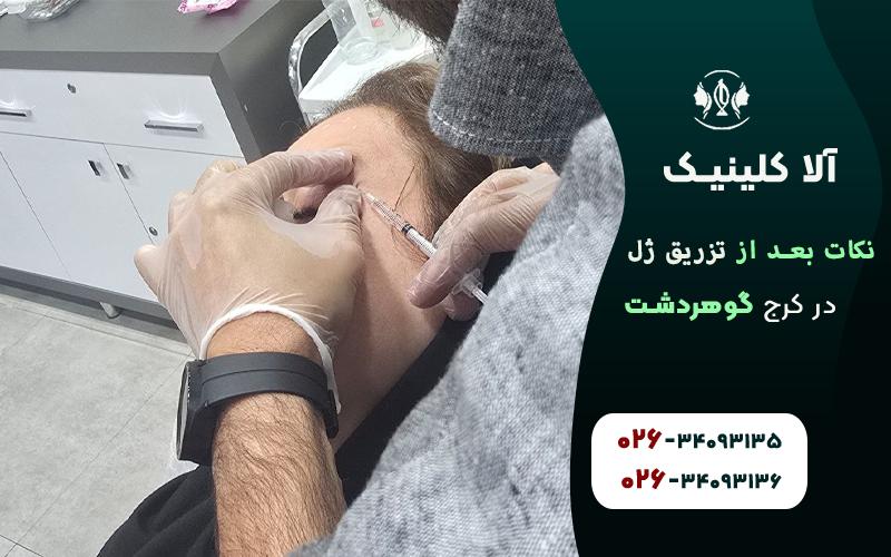 10نکته بعد از تزریق ژل که باید بدانید