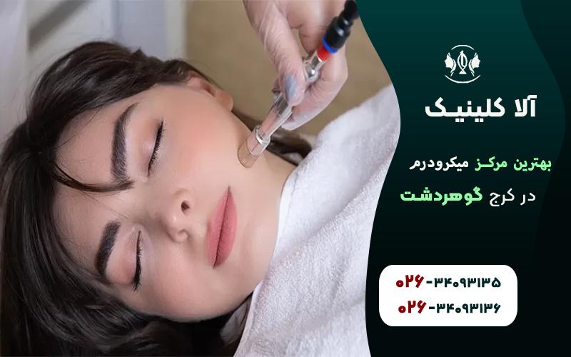 بهترین مرکز میکرودرم در کرج