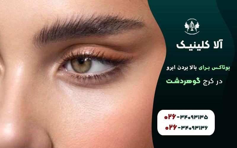 بوتاکس برای بالا بردن ابرو