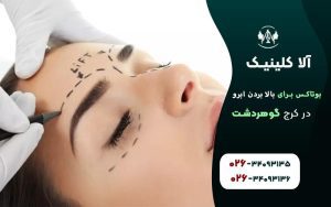 بوتاکس برای بالا بردن ابرو