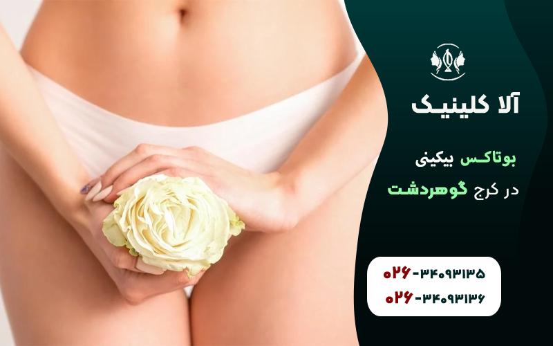 بوتاکس بیکینی