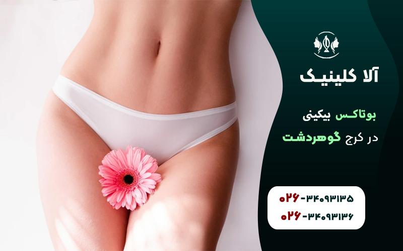 بوتاکس بیکینی