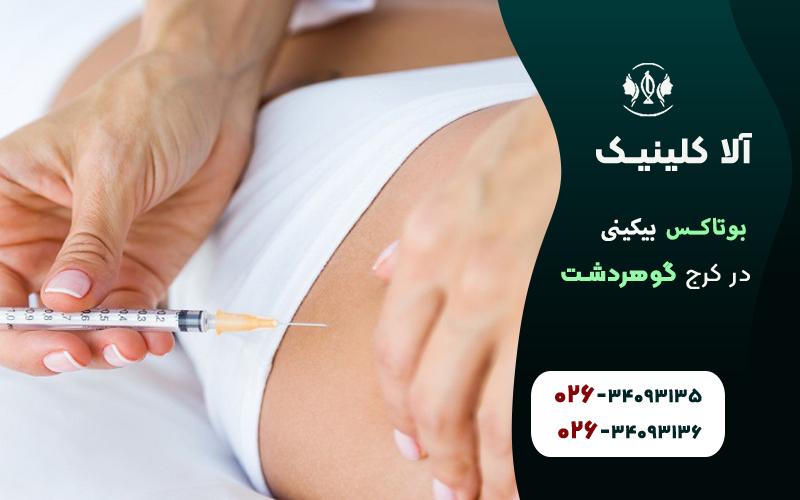 بوتاکس بیکینی