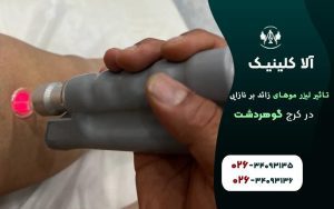 تاثیر لیزر موهای زائد بر نازایی