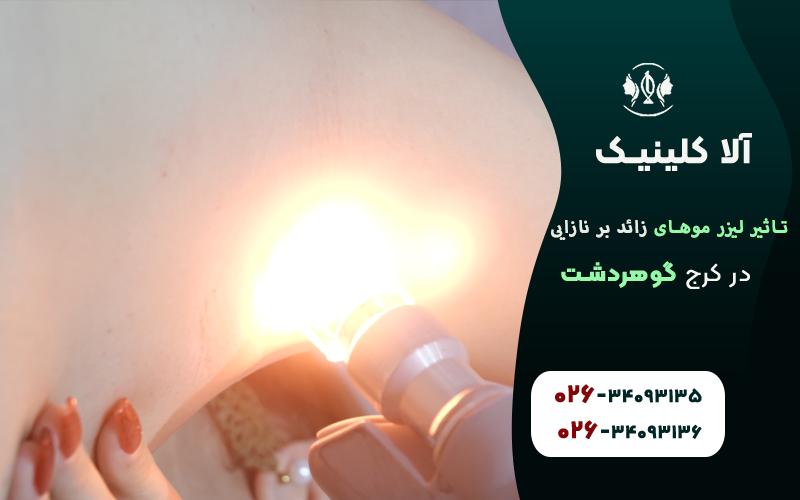 تاثیر لیزر موهای زائد بر نازایی