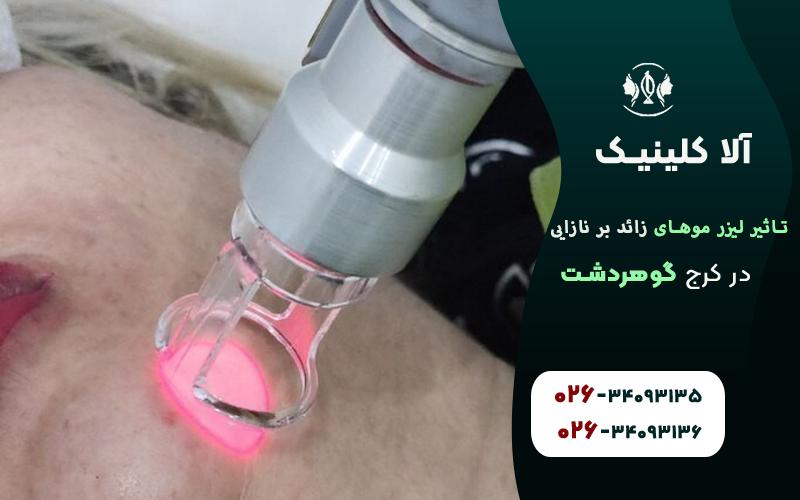 تاثیر لیزر موهای زائد بر نازایی