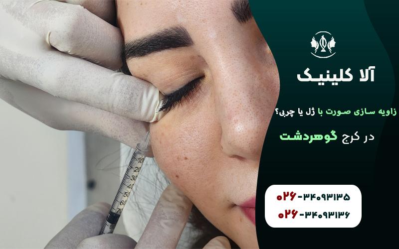 زاویه سازی صورت با ژل بهتر است یا چربی