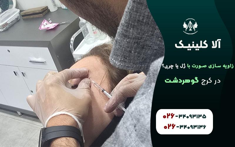 زاویه سازی صورت با ژل بهتر است یا چربی